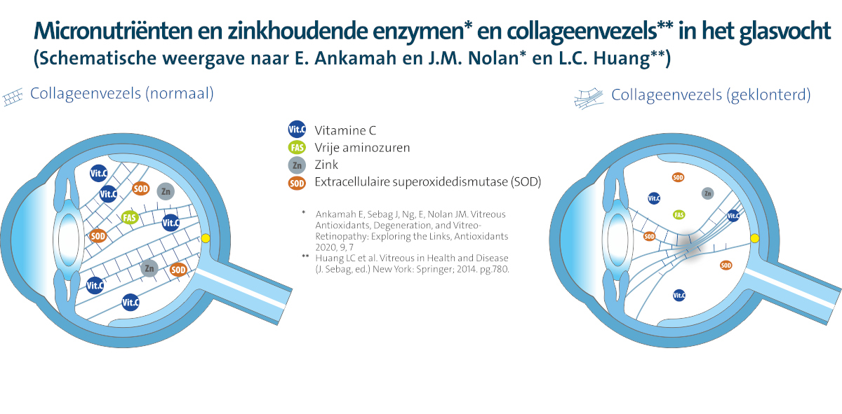 Schematische illustratie van het glasvocht met collageenvezels in normale en in geklonterde toestand. Links: normale collageenvezels ondersteund door micronutriënten en enzymen zoals vitamine C, vrije aminozuren, zink en extracellulaire superoxidedismutase (SOD). Rechts: geklonterde collageenvezels met minder micronutriënten. Gebaseerd op studies van E. Ankamah, J.M. Nolan en L.C. Huang.